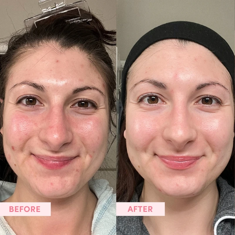 Sand & Sky The Essentials Marshmallow Toner 6 Sand & Sky The Essentials Marshmallow Toner – Image 6